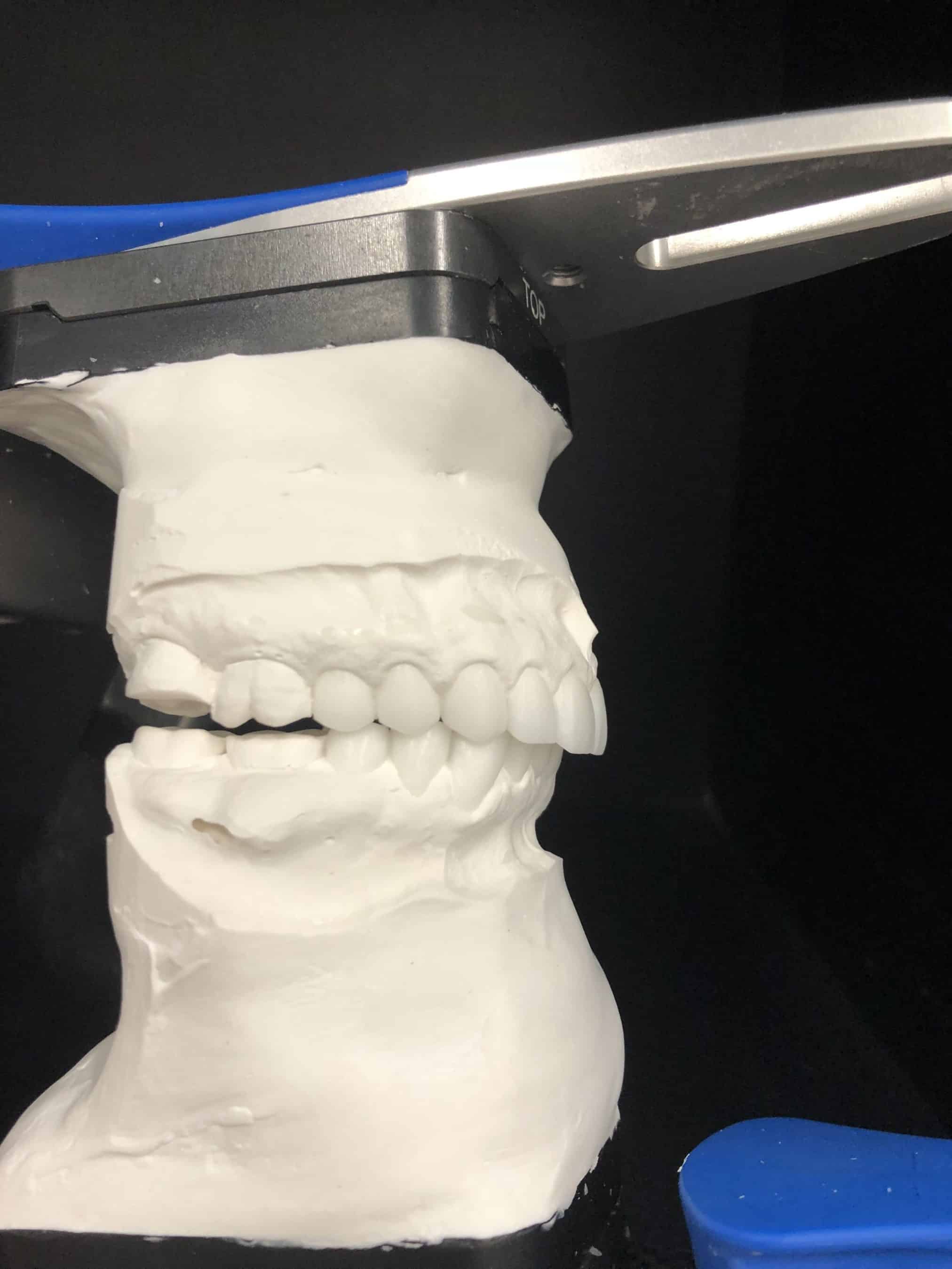 Cosmetic veneers waxup 1 Cosmetic Dental laboratory Image 3