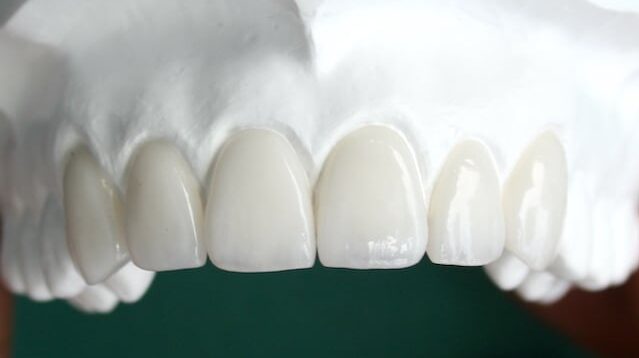 Dental Laboratory Zirconia Cosmetic crowns and Veneers