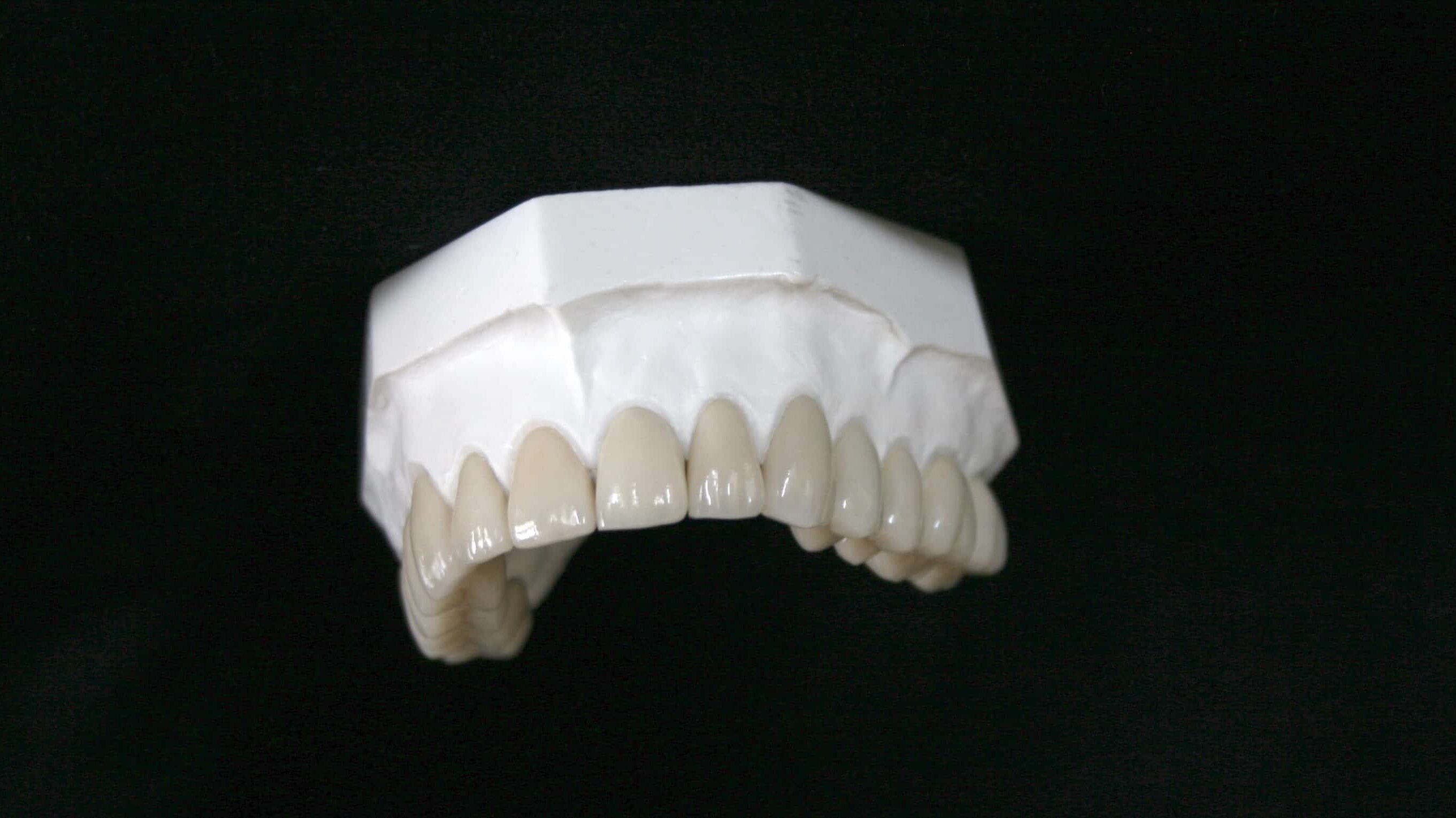 Implant Dental lab image 1 CAD CAM Zirconia Crowns Dental Laboratory
