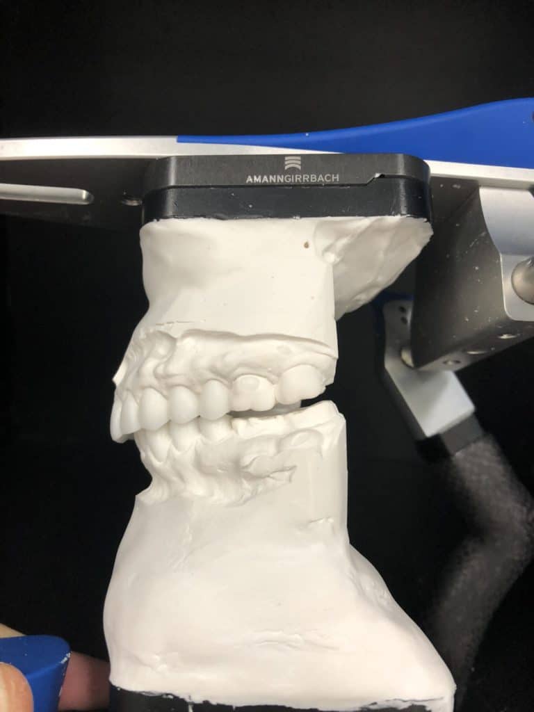 Cosmetic Dental Lab Highend digital restorative laboratory