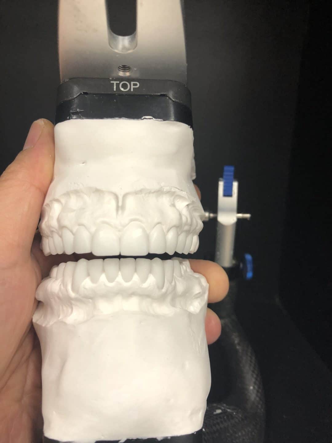 Cosmetic Dental Lab Highend digital restorative laboratory