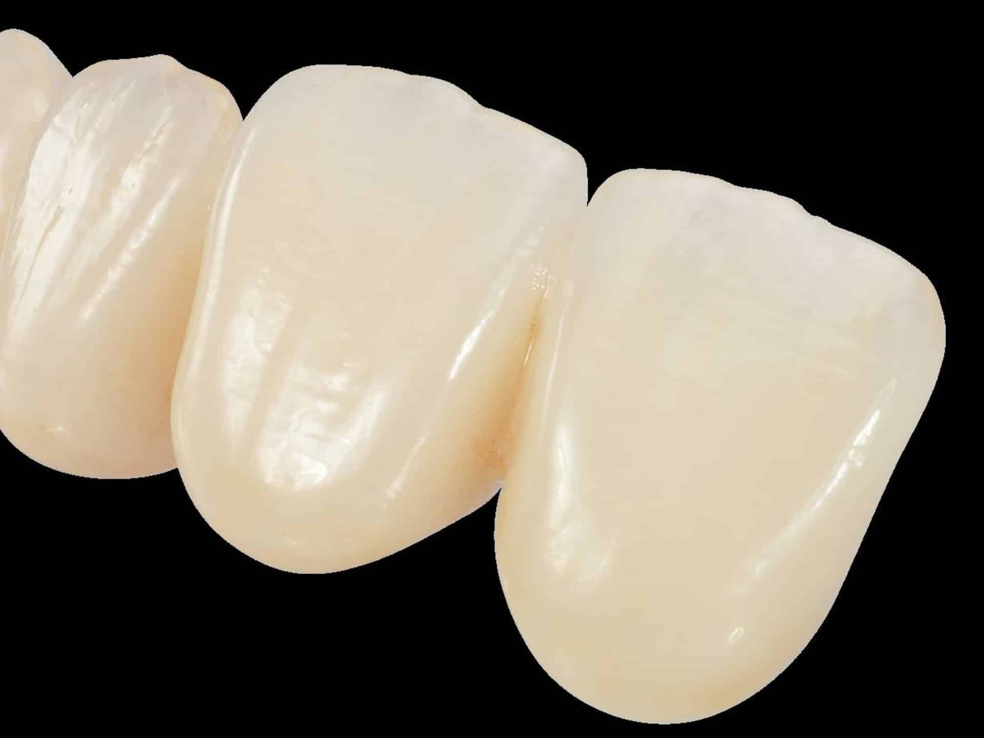 zircad dental lab image